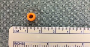 Bead that was removed from a two-year-old's ear