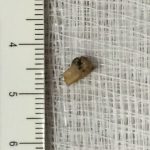 Stuff that got stuffed into ears and noses