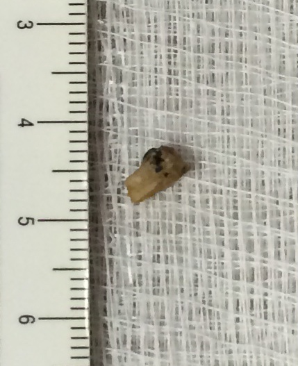 Stuff that got stuffed into ears and noses
