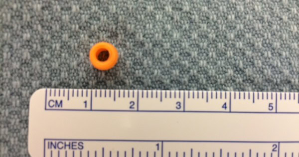 Small orange bead next to a ruler showing measurements in centimeters and inches, illustrating child safety awareness related to small objects.